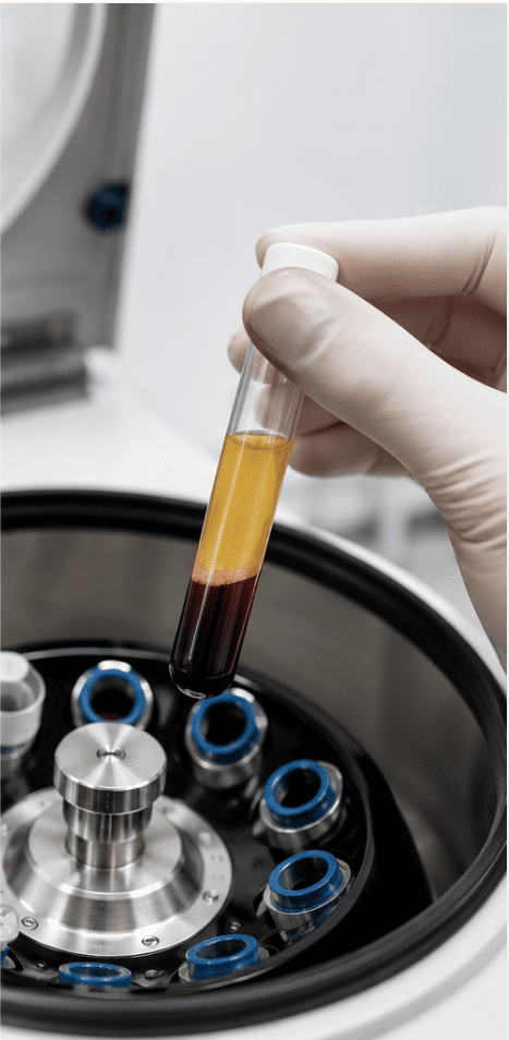 regenerative-medicine-prf-biologics-rogers-ar-clinical Regenerative medicine PRF biologics Rogers AR clinical